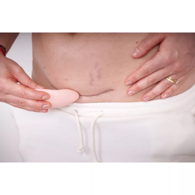 Momcare Laktációs és császármetszés utáni heg masszírozó