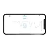 Milian légzésfigyelő PRO Bluetooth Standard 2db érzékelőlappal
