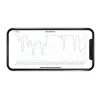 Milian légzésfigyelő PRO Bluetooth Standard 2db érzékelőlappal