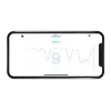 Milian légzésfigyelő Lite Bluetooth 2db érzékelőlappal